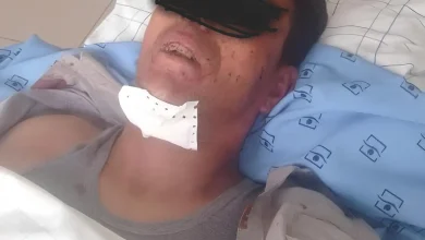العيون.. عسكري يبتر العضو التناسلي لرجل ضبطه مع زوجته